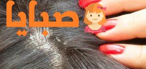 علاج قمل الرأس ونصائح للأمهات لتفادي إصابة أطفالهن بقمل الشعر 9