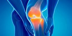 خشونة الركبة الاسباب والاعراض والعلاج بالتفصيل