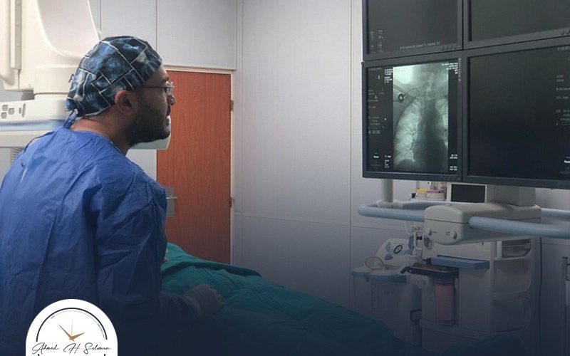 أسعار عمليات الأشعة التداخلية – الدكتور أحمد سليمان