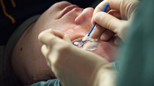 عمليات الليزك للعيون – علاج ضعف الإبصار
